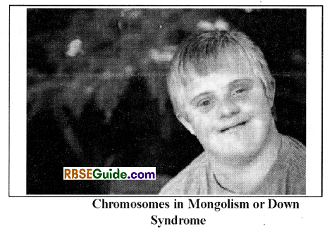 RBSE Class 12 Biology Notes Chapter 36 Man-Chromosomal Aberrations 2