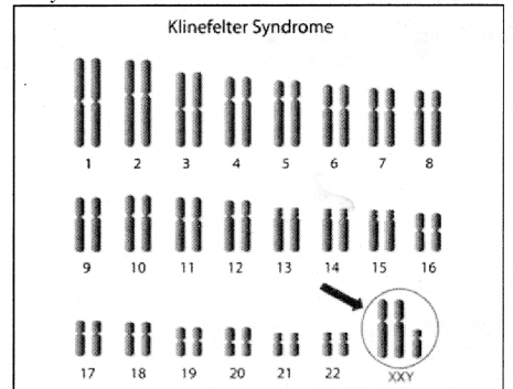 RBSE Class 12 Biology Notes Chapter 36 Man-Chromosomal Aberrations 3