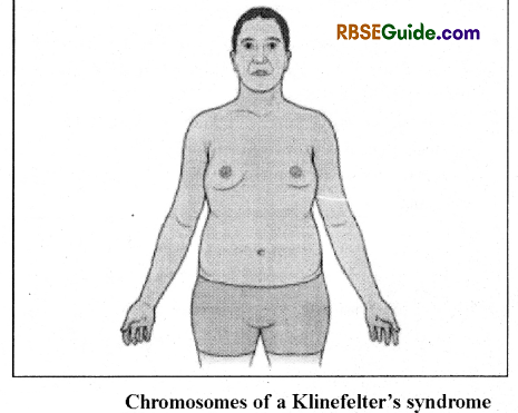RBSE Class 12 Biology Notes Chapter 36 Man-Chromosomal Aberrations 4
